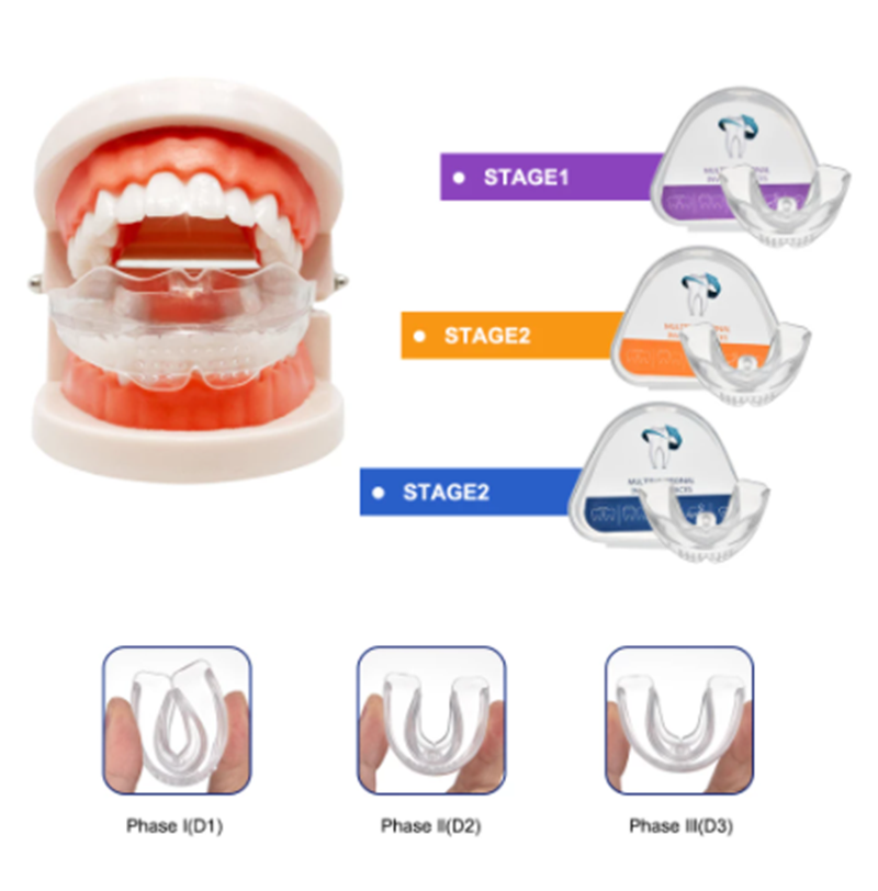 Clear Braces | 3-Stage Therapy for Crowded Teeth | Food-Grade TPE Material | Transparent Color | Orthodontic Solution