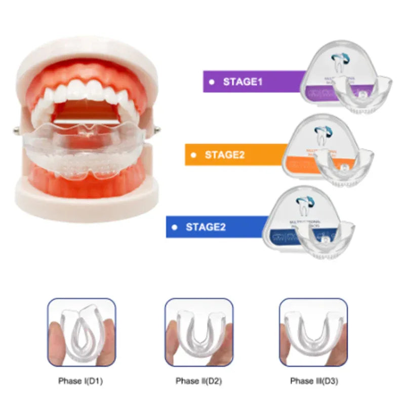 Clear Braces | 3-Stage Therapy for Crowded Teeth | Food-Grade TPE Material | Transparent Color | Orthodontic Solution Bazaare Mart Oral Care