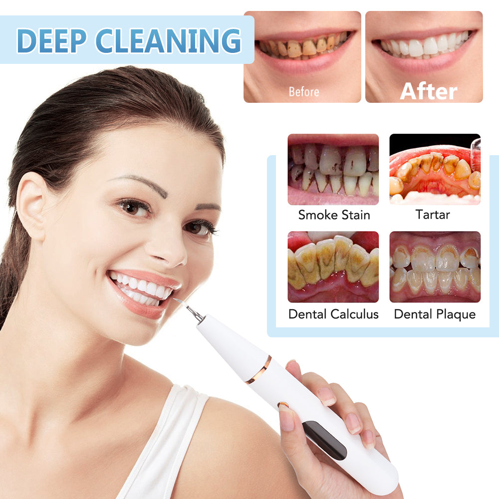Ultrasonic Tooth Calculus Remover - Bazaare Mart